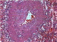 北京安定门中医医院 聚焦狼疮与白塞氏病等免疫疑难疾病的专业诊疗