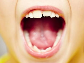 白塞氏病的特殊症状